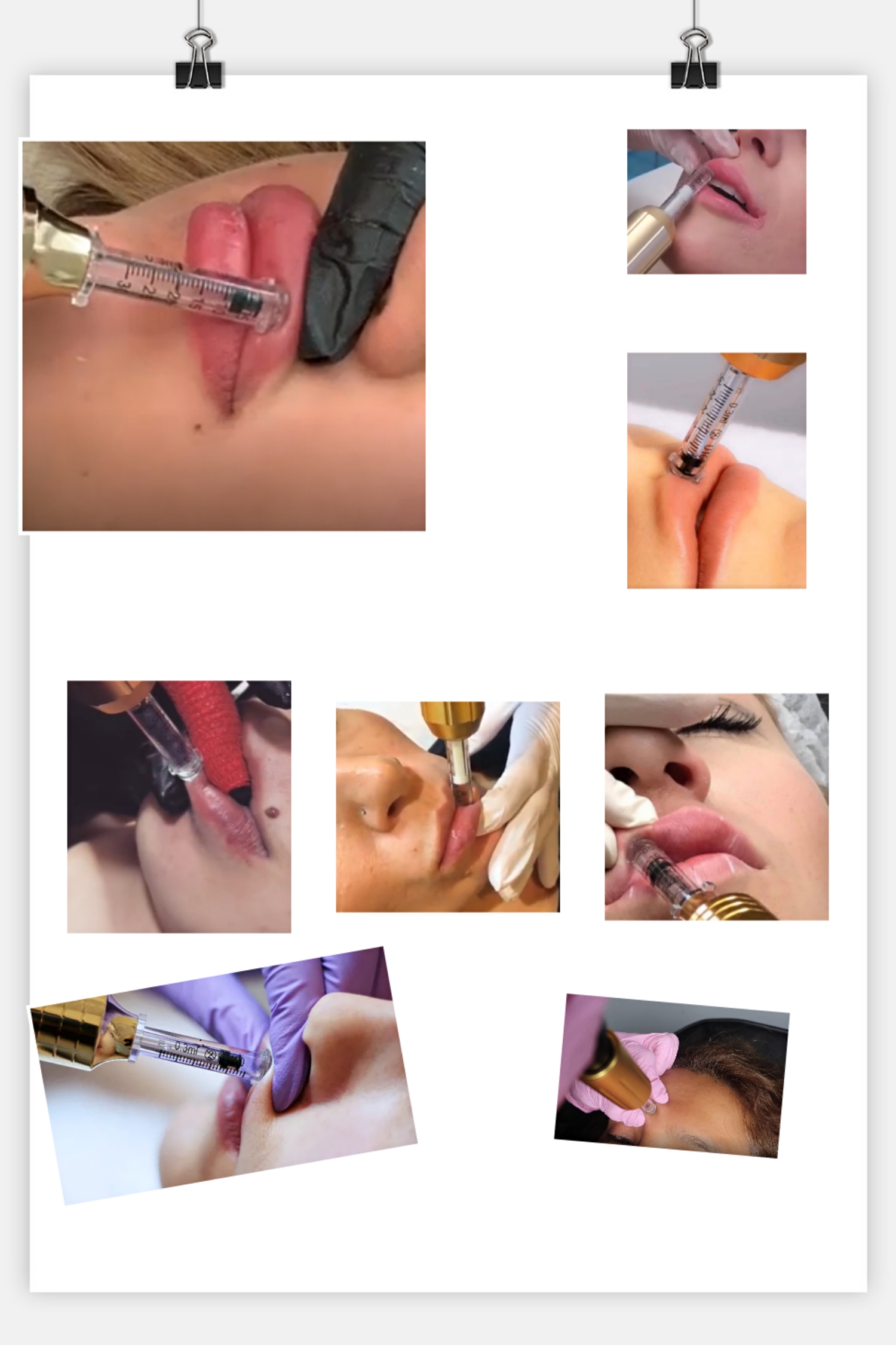 フォトバンク (141)