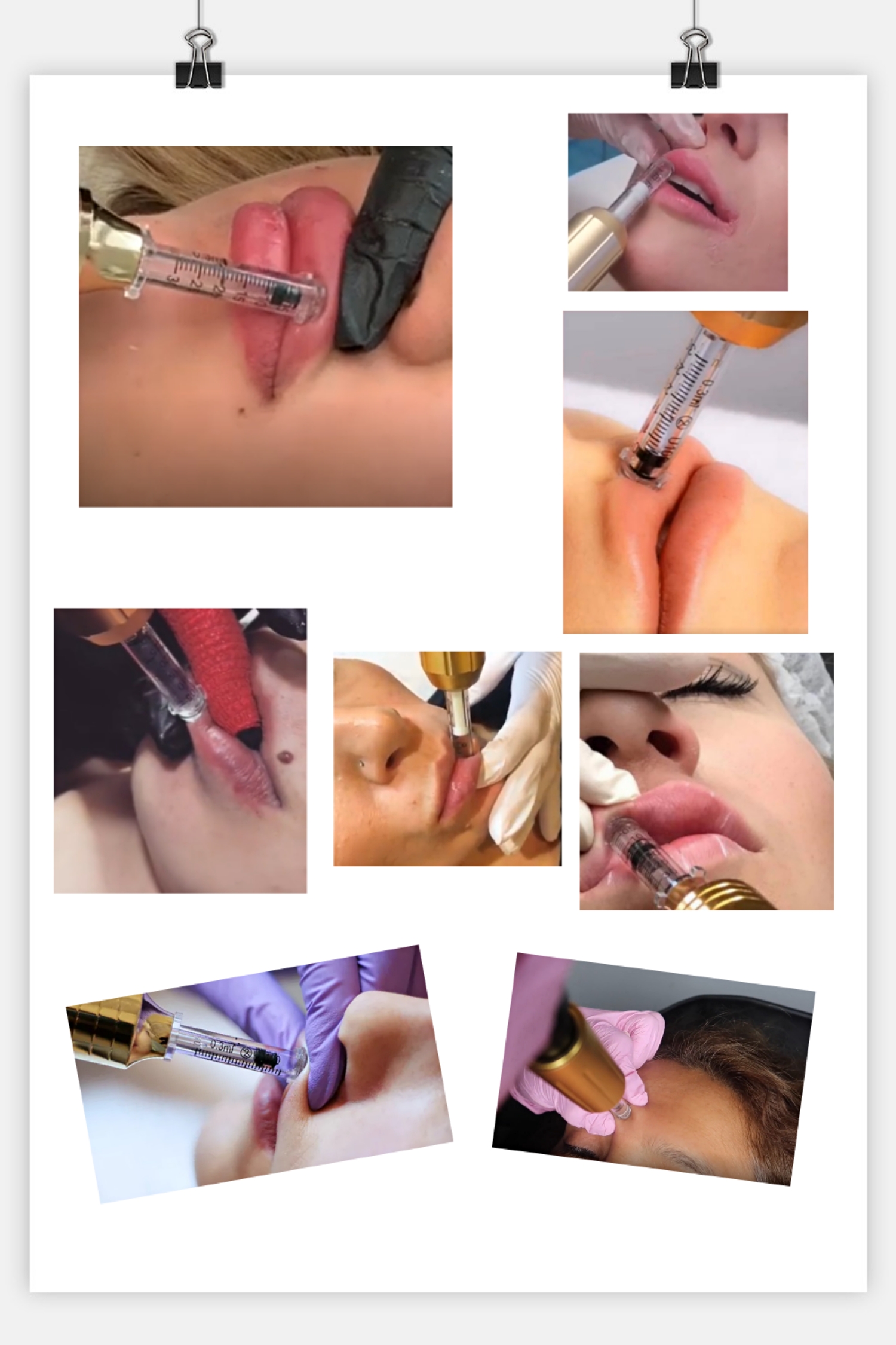 フォトバンク (140)