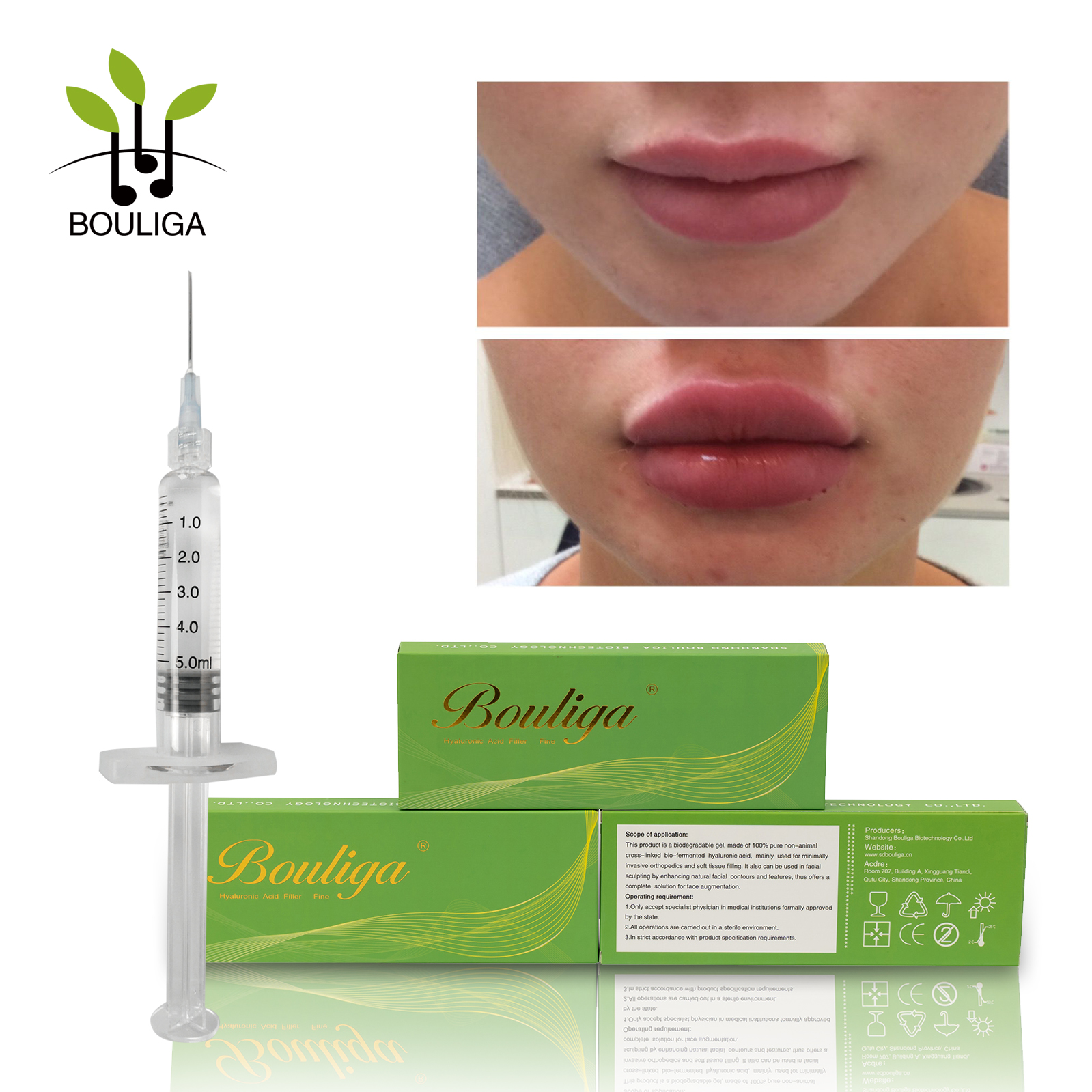 Bouliga 非外科的強化唇フィラー 5ml 皮膚フィラー